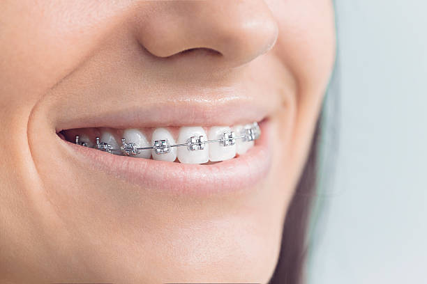 Best Dental Fillings (Composite and Amalgam)  in Greenfield, MO